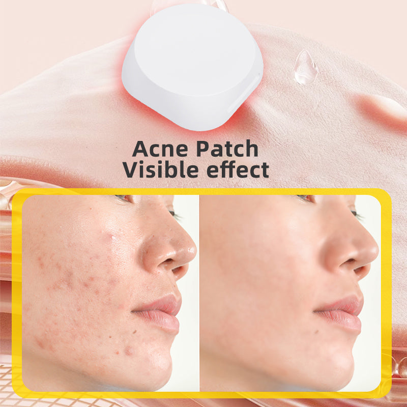 Mini Pimple Patch